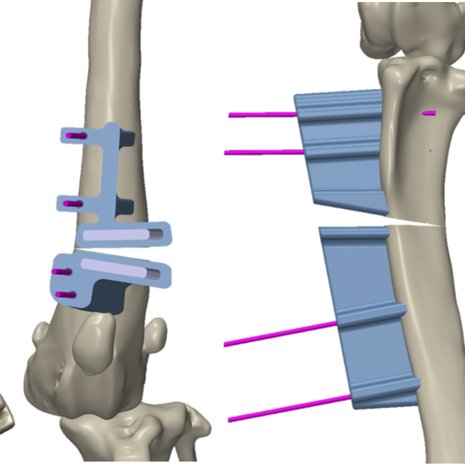 bio3Dvet_Veterinary_Custom Made Surgical Guides_3D Printing_Bioengineering_Advanced Veterinary Services_Κτηνιατρική_Εξατομικευμένοι Χειρουργικοί Οδηγοί_Τρισδιάστατη Εκτύπωση_Εμβιομηχανική_Προηγμένες Κτηνιατρικές Υπηρεσίες_I1