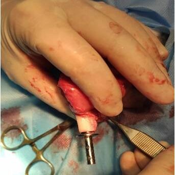 bio3Dvet_Veterinary_ITAP_Implant_Artificial Limb_Bionic Cat_Bioengineering_Advanced Veterinary Services_Perseus_Perseas_Περσέας_Custom Made Titanium Implant_Hydroxyapatite Coating_Κτηνιατρική_Βιονική Γάτα_Ενδομυελικό Εμφύτευμα_Τεχνητό Άκρο_Εμβιομηχανική_Προηγμένες Κτηνιατρικές Υπηρεσίες_Εξατομικευμένο Εμφύτευμα Τιτανίου_Επικάλυψη Υδροξυαπατίτη_Ι1