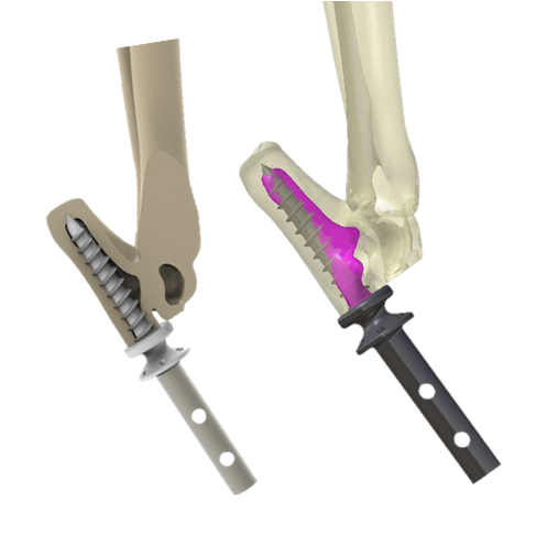 bio3Dvet_Veterinary_ITAP_Implant_Artificial Limb_Bionic Cat_Bioengineering_Advanced Veterinary Services_Custom Made Titanium Implant_Hydroxyapatite Coating_Perseus_Perseas_3D Printing_Περσέας_Κτηνιατρική_Βιονική Γάτα_Ενδομυελικό Εμφύτευμα_Τεχνητό Άκρο_Εμβιομηχανική_Προηγμένες Κτηνιατρικές Υπηρεσίες_Εξατομικευμένο Εμφύτευμα Τιτανίου_Επικάλυψη Υδροξυαπατίτη_Τρισδιάστατη Εκτύπωση_Ι5