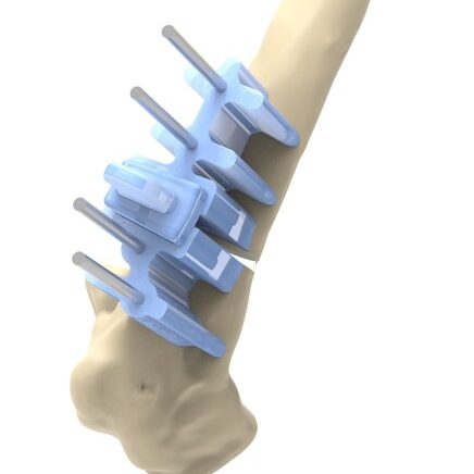 bio3Dvet_Veterinary_Custom Made Surgical Guides_3D Printing_Bioengineering_Advanced Veterinary Services_Κτηνιατρική_Εξατομικευμένοι Χειρουργικοί Οδηγοί_Τρισδιάστατη Εκτύπωση_Εμβιομηχανική_Προηγμένες Κτηνιατρικές Υπηρεσίες_I4