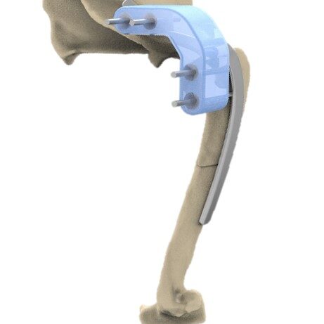 bio3Dvet_Veterinary_Custom Made Surgical Guides_3D Printing_Bioengineering_Advanced Veterinary Services_Κτηνιατρική_Εξατομικευμένοι Χειρουργικοί Οδηγοί_Τρισδιάστατη Εκτύπωση_Εμβιομηχανική_Προηγμένες Κτηνιατρικές Υπηρεσίες_I13