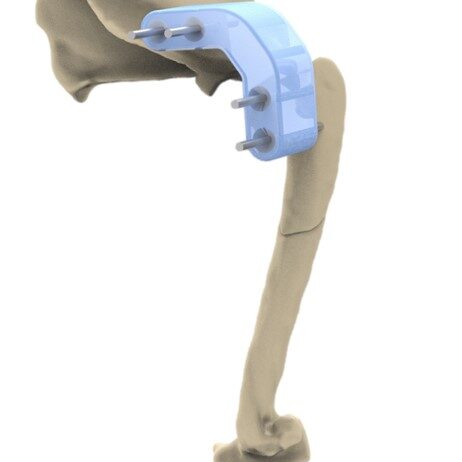 bio3Dvet_Veterinary_Custom Made Surgical Guides_3D Printing_Bioengineering_Advanced Veterinary Services_Κτηνιατρική_Εξατομικευμένοι Χειρουργικοί Οδηγοί_Τρισδιάστατη Εκτύπωση_Εμβιομηχανική_Προηγμένες Κτηνιατρικές Υπηρεσίες_I14