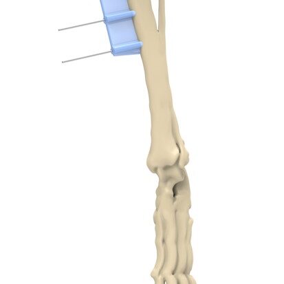 bio3Dvet_Veterinary_Custom Made Surgical Guides_3D Printing_Bioengineering_Advanced Veterinary Services_Κτηνιατρική_Εξατομικευμένοι Χειρουργικοί Οδηγοί_Τρισδιάστατη Εκτύπωση_Εμβιομηχανική_Προηγμένες Κτηνιατρικές Υπηρεσίες_I17