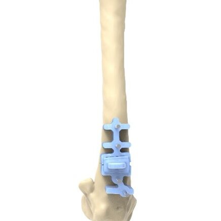 bio3Dvet_Veterinary_Custom Made Surgical Guides_3D Printing_Bioengineering_Advanced Veterinary Services_Κτηνιατρική_Εξατομικευμένοι Χειρουργικοί Οδηγοί_Τρισδιάστατη Εκτύπωση_Εμβιομηχανική_Προηγμένες Κτηνιατρικές Υπηρεσίες_I5