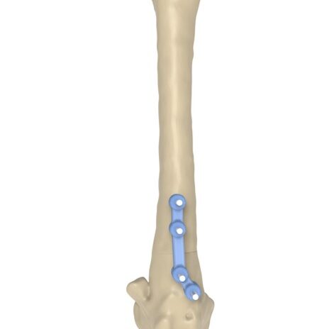 bio3Dvet_Veterinary_Custom Made Surgical Guides_3D Printing_Bioengineering_Advanced Veterinary Services_Κτηνιατρική_Εξατομικευμένοι Χειρουργικοί Οδηγοί_Τρισδιάστατη Εκτύπωση_Εμβιομηχανική_Προηγμένες Κτηνιατρικές Υπηρεσίες_I7
