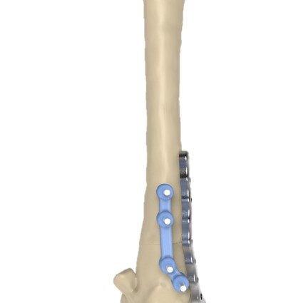 bio3Dvet_Veterinary_Custom Made Surgical Guides_3D Printing_Bioengineering_Advanced Veterinary Services_Κτηνιατρική_Εξατομικευμένοι Χειρουργικοί Οδηγοί_Τρισδιάστατη Εκτύπωση_Εμβιομηχανική_Προηγμένες Κτηνιατρικές Υπηρεσίες_I8